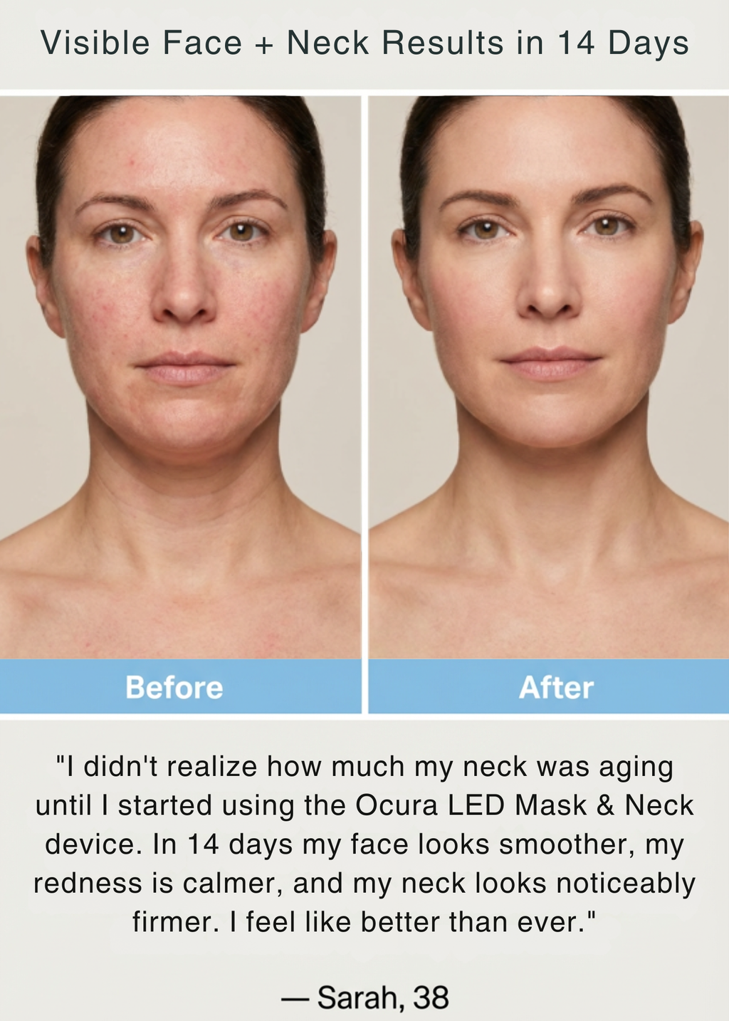 LED Skin Rejuvenation Mask & Neck