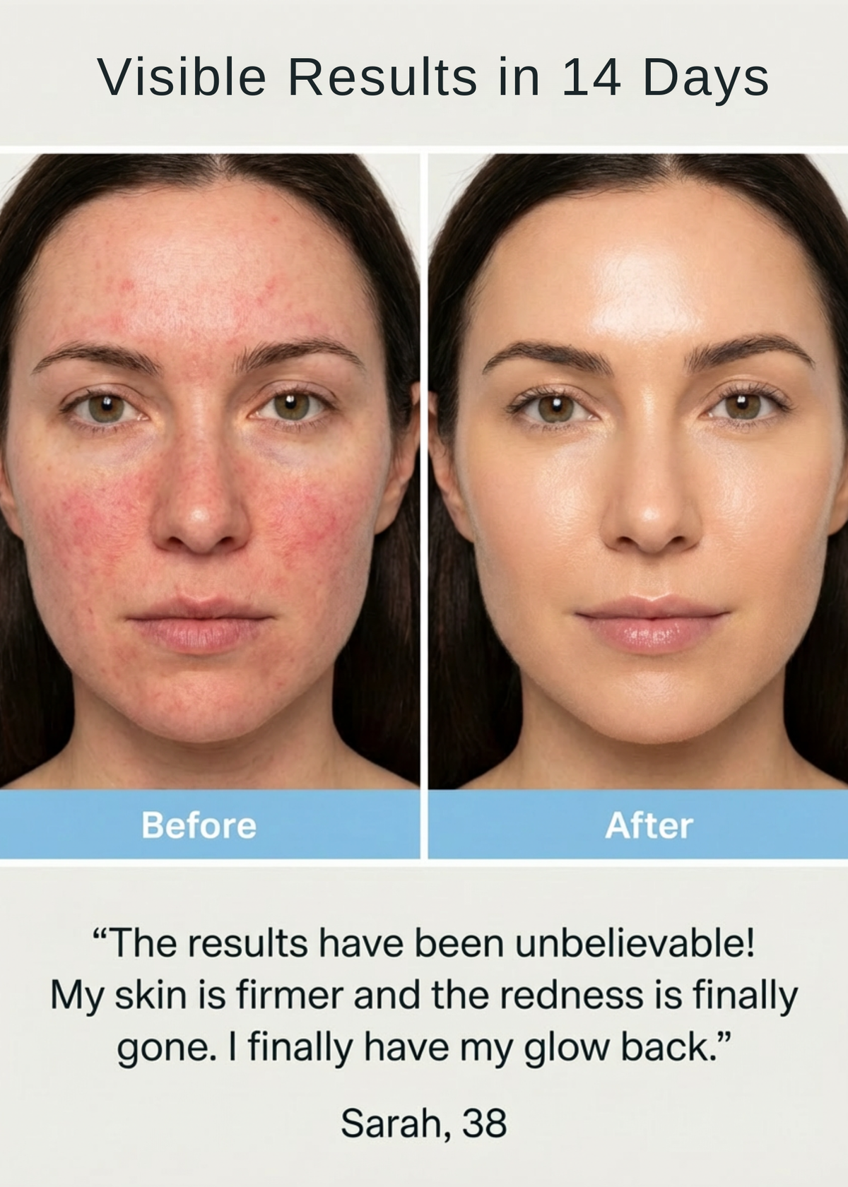 LED Skin Rejuvenation Mask