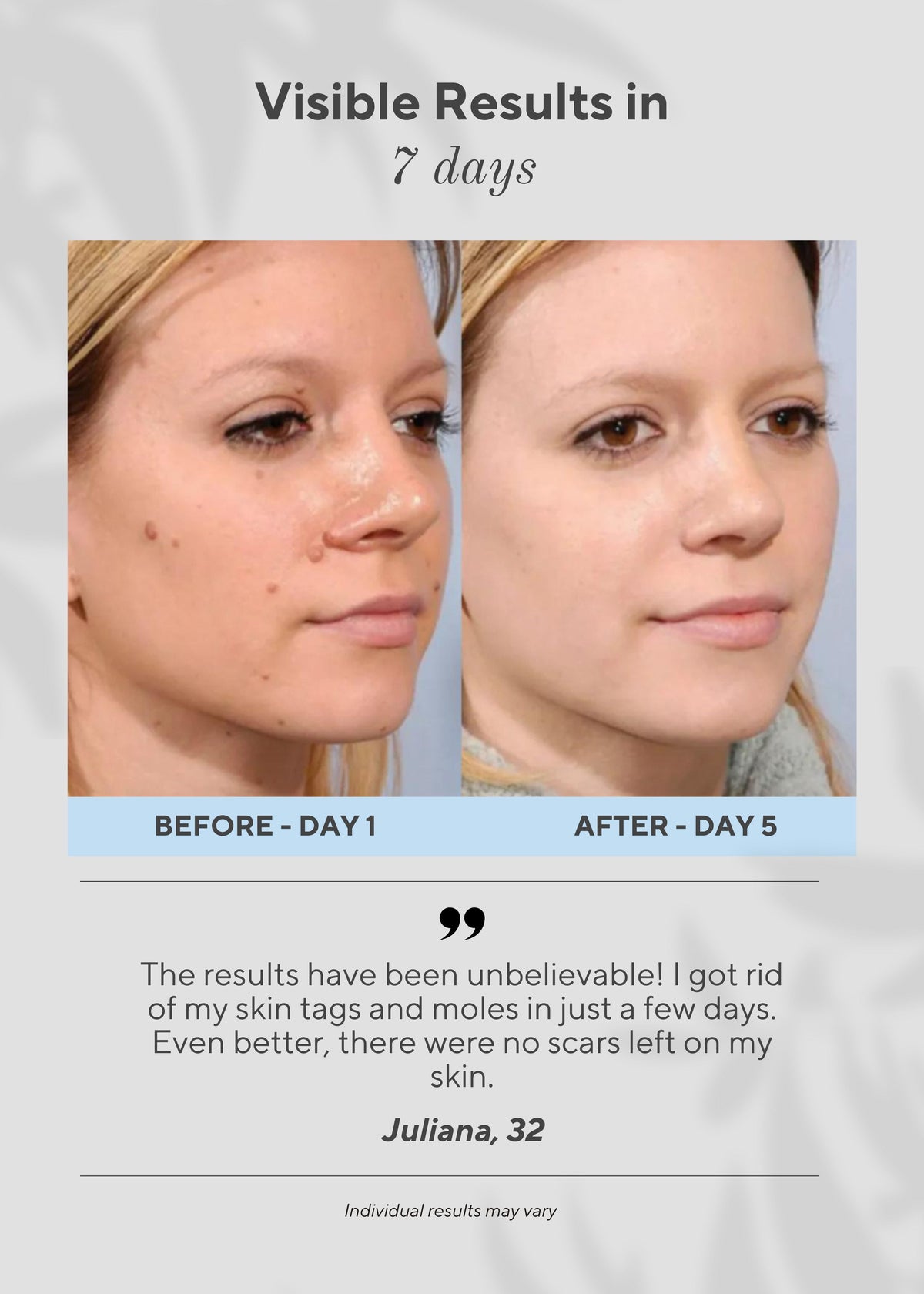 6-in-1 Skin Imperfection Removal Pen